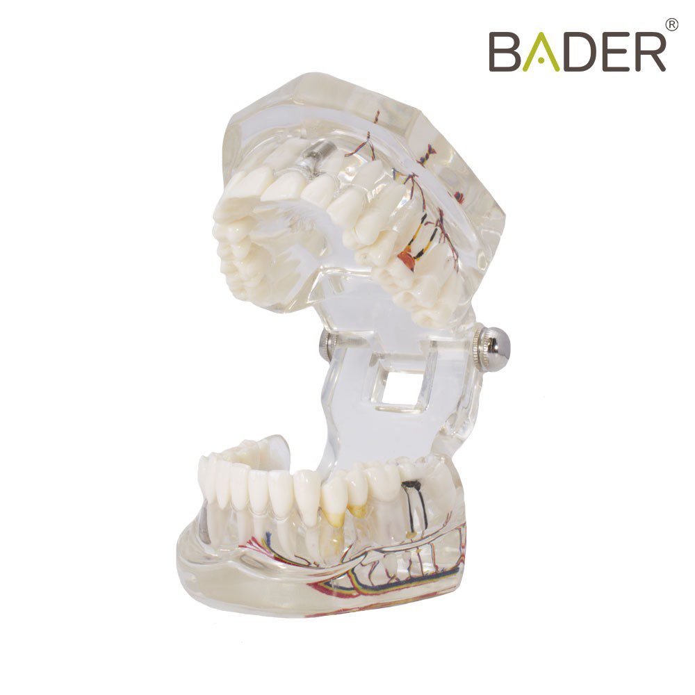 4062-Modello dentale di impianto con nervo.jpg