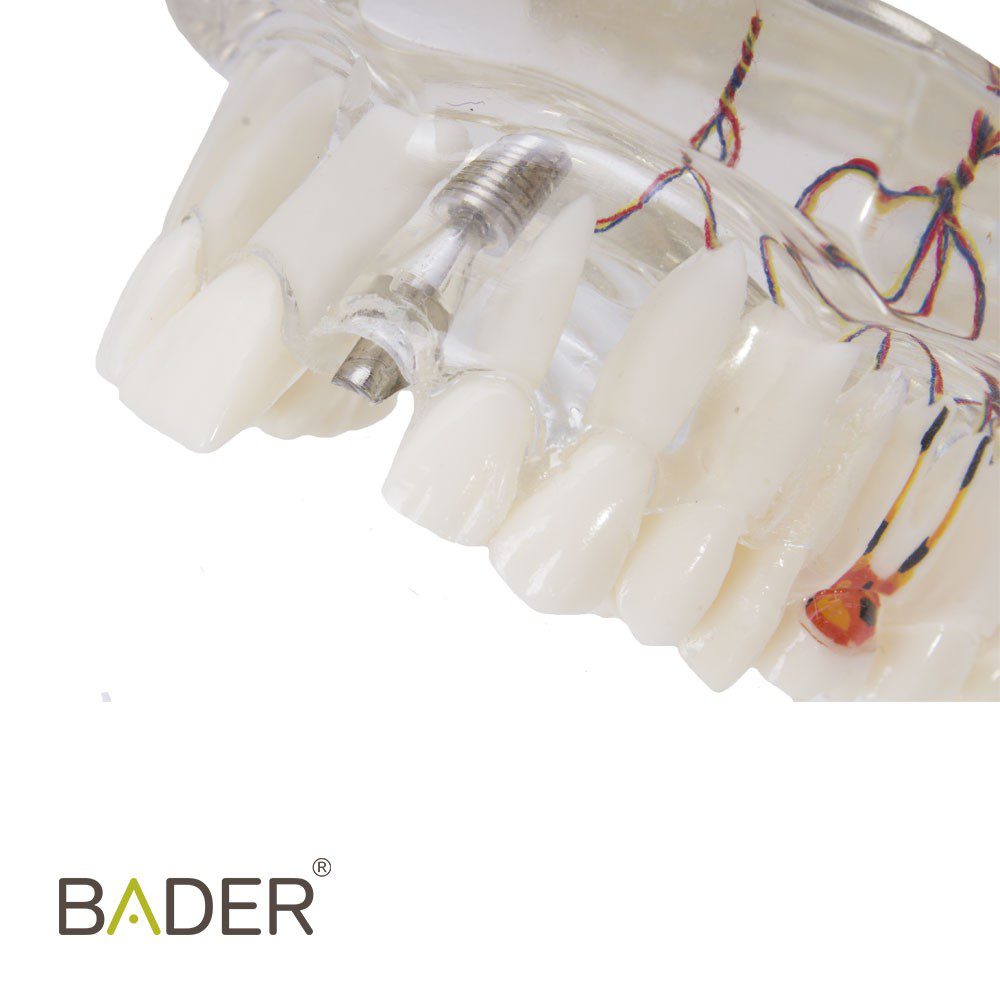 4064-Modèle dentaire d'implant avec nerf.jpg