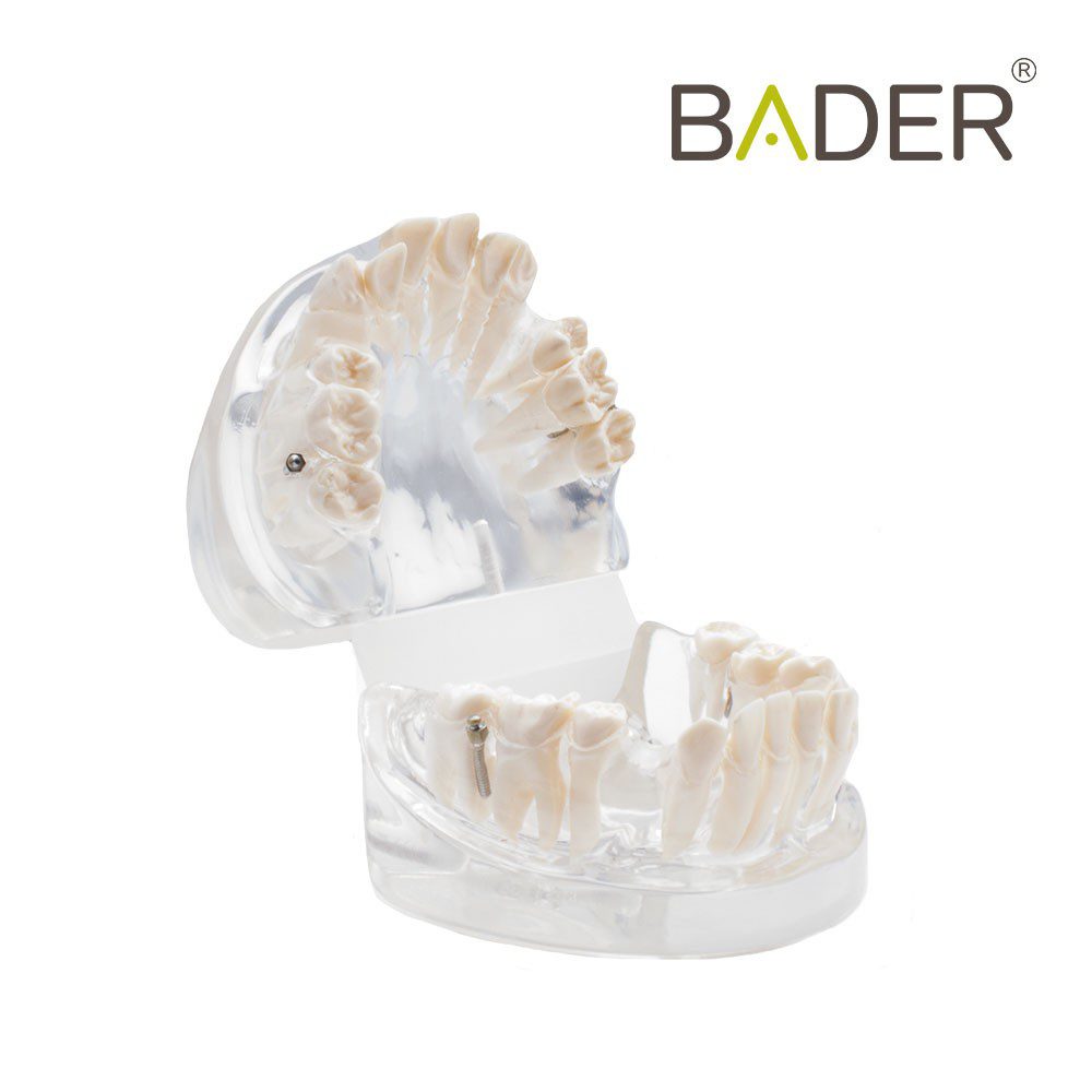 4841-DENTAL-MODEL-FOR-PRACTICE-Orthodontics-BADER.jpg
